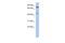 Ring Finger Protein 169 antibody, A10407, Boster Biological Technology, Western Blot image 