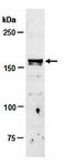 Tet Methylcytosine Dioxygenase 3 antibody, orb67242, Biorbyt, Western Blot image 