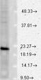 Vesicle Associated Membrane Protein 1 antibody, LS-C227440, Lifespan Biosciences, Western Blot image 