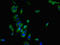C-C Motif Chemokine Receptor 7 antibody, LS-C669816, Lifespan Biosciences, Immunofluorescence image 