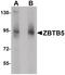 Zinc Finger And BTB Domain Containing 5 antibody, PA5-21085, Invitrogen Antibodies, Western Blot image 