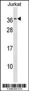 RAB8B, Member RAS Oncogene Family antibody, 60-277, ProSci, Western Blot image 