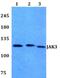 Janus Kinase 3 antibody, GTX66640, GeneTex, Western Blot image 