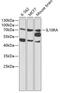 Interleukin 10 Receptor Subunit Alpha antibody, 18-334, ProSci, Western Blot image 