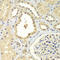 Zinc Finger Protein 346 antibody, LS-C349201, Lifespan Biosciences, Immunohistochemistry paraffin image 
