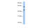 Netrin 4 antibody, ARP49645_P050, Aviva Systems Biology, Western Blot image 