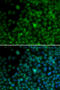 Interferon Regulatory Factor 4 antibody, STJ24229, St John