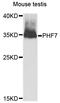 PHD Finger Protein 7 antibody, PA5-76565, Invitrogen Antibodies, Western Blot image 