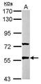 Gamma-Aminobutyric Acid Type A Receptor Rho2 Subunit antibody, PA5-29472, Invitrogen Antibodies, Western Blot image 