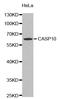 Caspase 10 antibody, STJ22894, St John