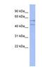 Deleted In Azoospermia 4 antibody, NBP1-57480, Novus Biologicals, Western Blot image 