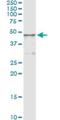 Homogentisate 1,2-Dioxygenase antibody, H00003081-M11, Novus Biologicals, Immunoprecipitation image 