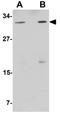 N(Alpha)-Acetyltransferase 40, NatD Catalytic Subunit antibody, GTX85214, GeneTex, Western Blot image 