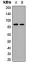Mitofusin 2 antibody, LS-C358807, Lifespan Biosciences, Western Blot image 