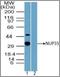 Nucleoporin 35 antibody, orb96274, Biorbyt, Western Blot image 