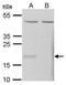 Glutathione Peroxidase 7 antibody, PA5-28854, Invitrogen Antibodies, Western Blot image 