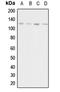 Adenylate Cyclase 1 antibody, GTX54886, GeneTex, Western Blot image 