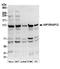 Huntingtin Interacting Protein 1 Related antibody, A304-804A, Bethyl Labs, Western Blot image 