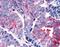 G Protein-Coupled Estrogen Receptor 1 antibody, NLS1184, Novus Biologicals, Immunohistochemistry paraffin image 