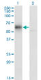 Rho GDP Dissociation Inhibitor Alpha antibody, LS-C197288, Lifespan Biosciences, Western Blot image 