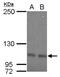 OCRL Inositol Polyphosphate-5-Phosphatase antibody, NBP2-19621, Novus Biologicals, Western Blot image 
