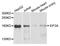Eukaryotic Translation Initiation Factor 3 Subunit A antibody, orb136571, Biorbyt, Western Blot image 