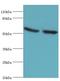 Glucosylceramidase Beta 3 (Gene/Pseudogene) antibody, LS-C379987, Lifespan Biosciences, Western Blot image 