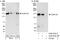 Valosin Containing Protein Interacting Protein 1 antibody, A302-933A, Bethyl Labs, Immunoprecipitation image 