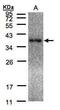 Laforin antibody, PA5-28073, Invitrogen Antibodies, Western Blot image 