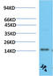 Transthyretin antibody, STJ98878, St John