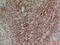 Neuregulin 2 antibody, STJ96580, St John