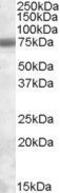 EXOSC9 antibody, GTX88547, GeneTex, Western Blot image 