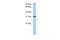 Activating Transcription Factor 1 antibody, PA5-40359, Invitrogen Antibodies, Western Blot image 