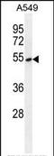 Tyrosyl-DNA Phosphodiesterase 2 antibody, PA5-35039, Invitrogen Antibodies, Western Blot image 