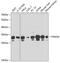 Proteasome Subunit Alpha 4 antibody, GTX65846, GeneTex, Western Blot image 