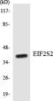 Eukaryotic Translation Initiation Factor 2 Subunit Beta antibody, LS-C291919, Lifespan Biosciences, Western Blot image 