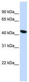 Transmembrane Protein 117 antibody, TA339606, Origene, Western Blot image 