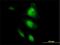 Heat Shock Protein Family A (Hsp70) Member 2 antibody, H00003306-M02, Novus Biologicals, Immunocytochemistry image 