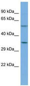 G Protein Subunit Alpha 12 antibody, TA334419, Origene, Western Blot image 