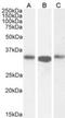 Actin Related Protein 2/3 Complex Subunit 2 antibody, NB100-1037, Novus Biologicals, Western Blot image 