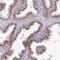 Von Willebrand Factor A Domain Containing 5A antibody, NBP1-89998, Novus Biologicals, Immunohistochemistry paraffin image 