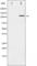 Histone Deacetylase 5 antibody, abx010905, Abbexa, Western Blot image 