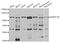 DNA Methyltransferase 3 Beta antibody, abx006005, Abbexa, Western Blot image 