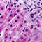 Cytochrome P450 Family 21 Subfamily A Member 2 antibody, LS-C355985, Lifespan Biosciences, Immunohistochemistry paraffin image 