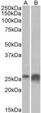 Apolipoprotein D antibody, TA326726, Origene, Western Blot image 