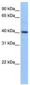 Pyridoxal Kinase antibody, TA335765, Origene, Western Blot image 