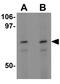 Activating Transcription Factor 6 antibody, GTX31729, GeneTex, Western Blot image 