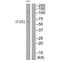 Insulin Like Growth Factor 2 MRNA Binding Protein 3 antibody, PA5-49760, Invitrogen Antibodies, Western Blot image 