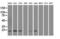 Adenylate Kinase 1 antibody, GTX84939, GeneTex, Western Blot image 