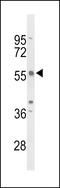 Tandem C2 Domains, Nuclear antibody, LS-C161677, Lifespan Biosciences, Western Blot image 